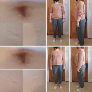 scarwork results